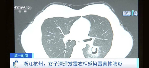 墙面发霉致癌？电渗脉冲技术‘抽干’墙体水分，30年不发霉